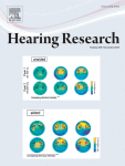 Factors that can affect divided speech intelligibility