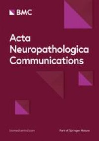 Glioblastoma pseudoprogression and true progression reveal spatially variable transcriptional differences