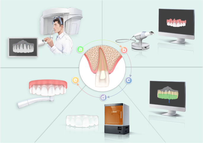 Expert consensus on digital guided therapy for endodontic diseases