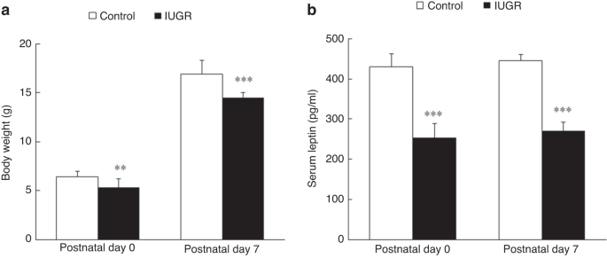 Uteroplacental insufficiency decreases leptin expression and impairs lung development in growth-restricted newborn rats