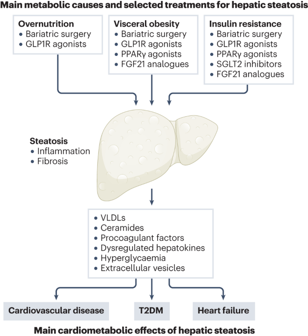 Role of steatotic liver disease in prediction and prevention of cardiometabolic diseases