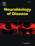 The effects of P2 segment of posterior cerebral artery to thalamus blood supply pattern on gait in cerebral small vessel disease: A 7 T MRI based study