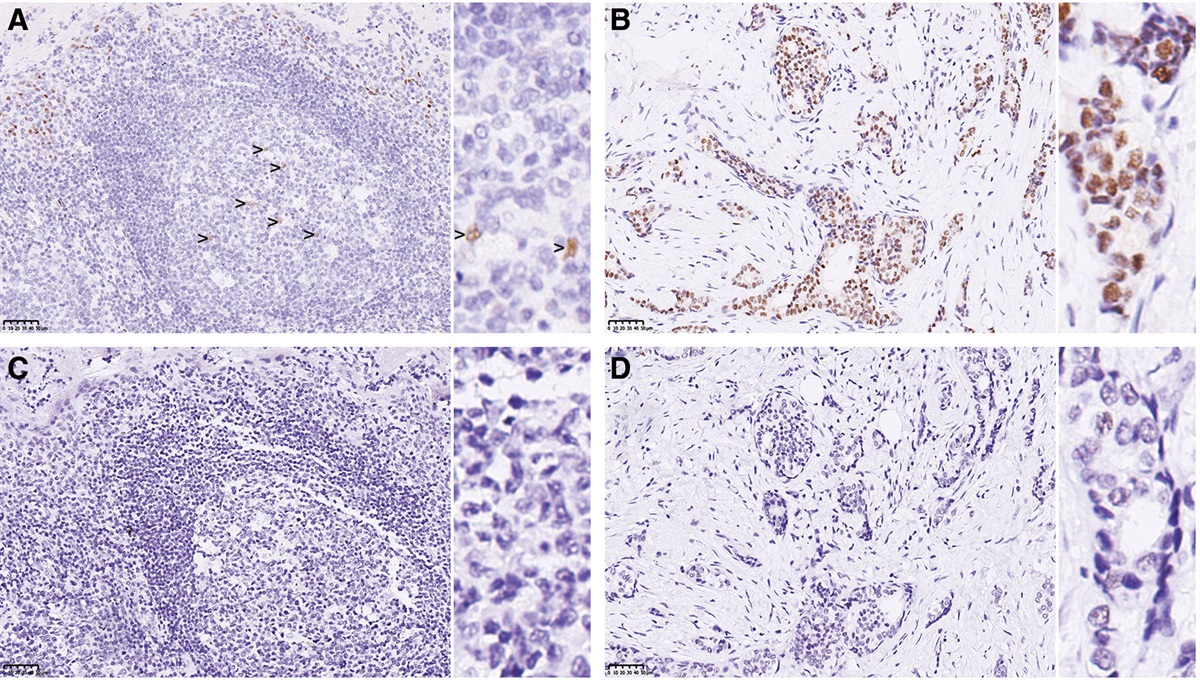 Tonsil tissue control is ideal for monitoring estrogen receptor immunohistochemical staining