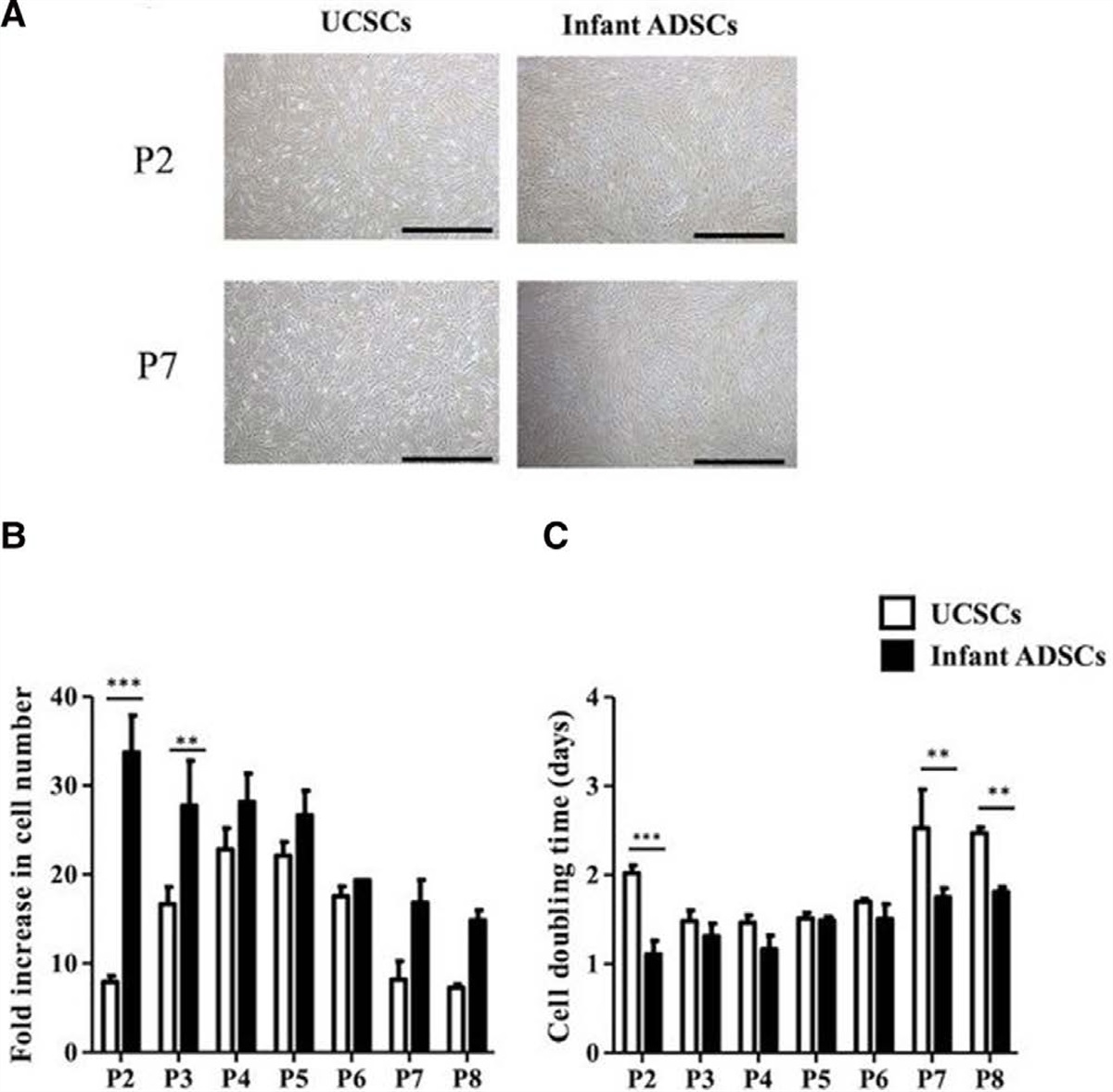 Multilineage differentiation potential in the infant adipose- and umbilical cord-derived mesenchymal stem cells