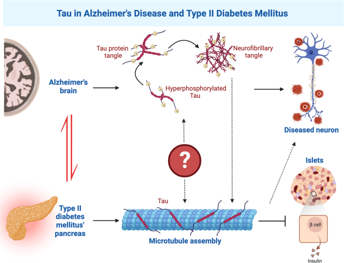 Tau in the pancreas: understanding the link between type 2 diabetes mellitus and Alzheimer’s disease