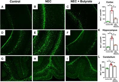 Butyrate suppresses experimental necrotizing enterocolitis–induced brain injury in mice