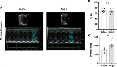 Enhanced central sympathetic tone induces heart failure with preserved ejection fraction (HFpEF) in rats