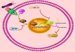 Enhanced expression of miR-204 attenuates LPS stimulated inflammatory injury through inhibiting the Wnt/β-catenin pathway via targeting CCND2