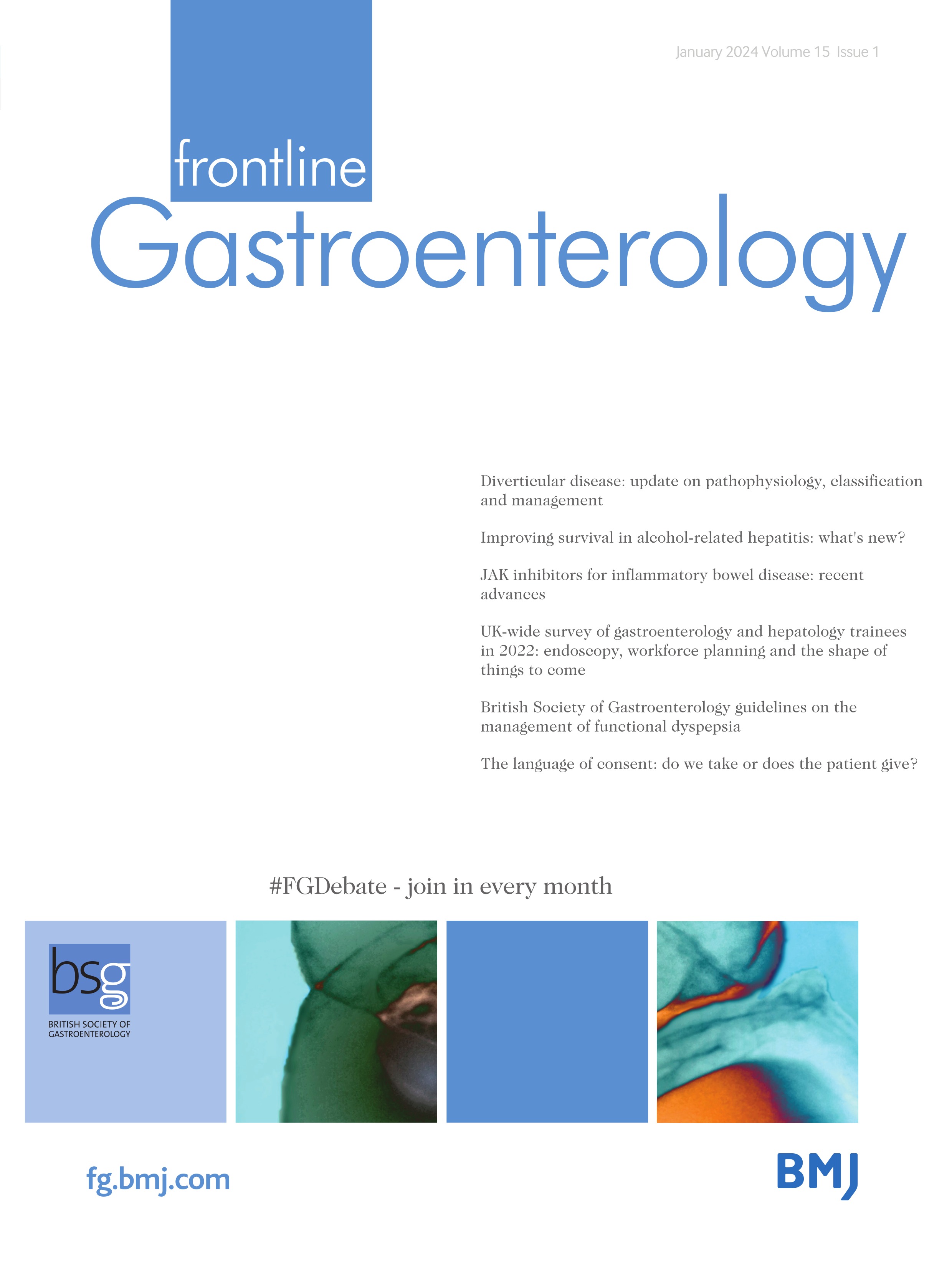 British Society of Gastroenterology guidelines on the management of functional dyspepsia