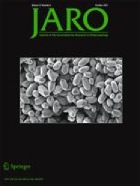 Spectral Grouping of Electrically Encoded Sound Predicts Speech-in-Noise Performance in Cochlear Implantees