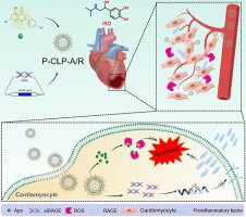 PEG-modified nano liposomes co-deliver Apigenin and RAGE-siRNA to protect myocardial ischemia injury