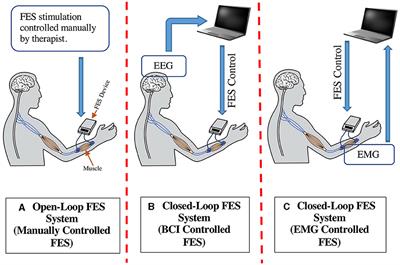 A systematic review on functional electrical stimulation based rehabilitation systems for upper limb post-stroke recovery