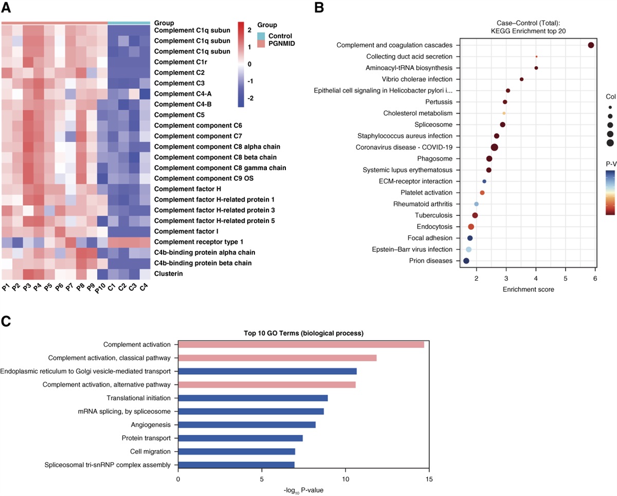 Characteristics of Complement Protein Deposition in Proliferative Glomerulonephritis with Monoclonal Immunoglobulin Deposition