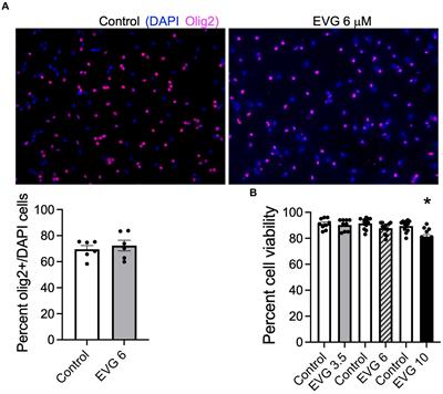 Inhibition of lipid synthesis by the HIV integrase strand transfer inhibitor elvitegravir in primary rat oligodendrocyte cultures