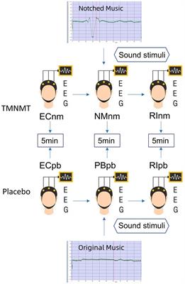 EEG spectral and microstate analysis originating residual inhibition of tinnitus induced by tailor-made notched music training