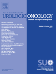 Higher prevalence of benign tumors in men with testicular tumors and history of treated cryptorchidism