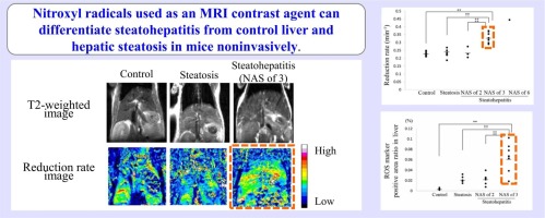 Non-invasive differentiation of hepatic steatosis and steatohepatitis in a mouse model using nitroxyl radical as an MRI-contrast agent