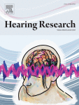 Mechanisms of age-related hearing loss at the auditory nerve central synapses and postsynaptic neurons in the cochlear nucleus