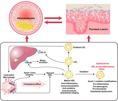 Psoriasis comorbid with atherosclerosis meets in lipid metabolism