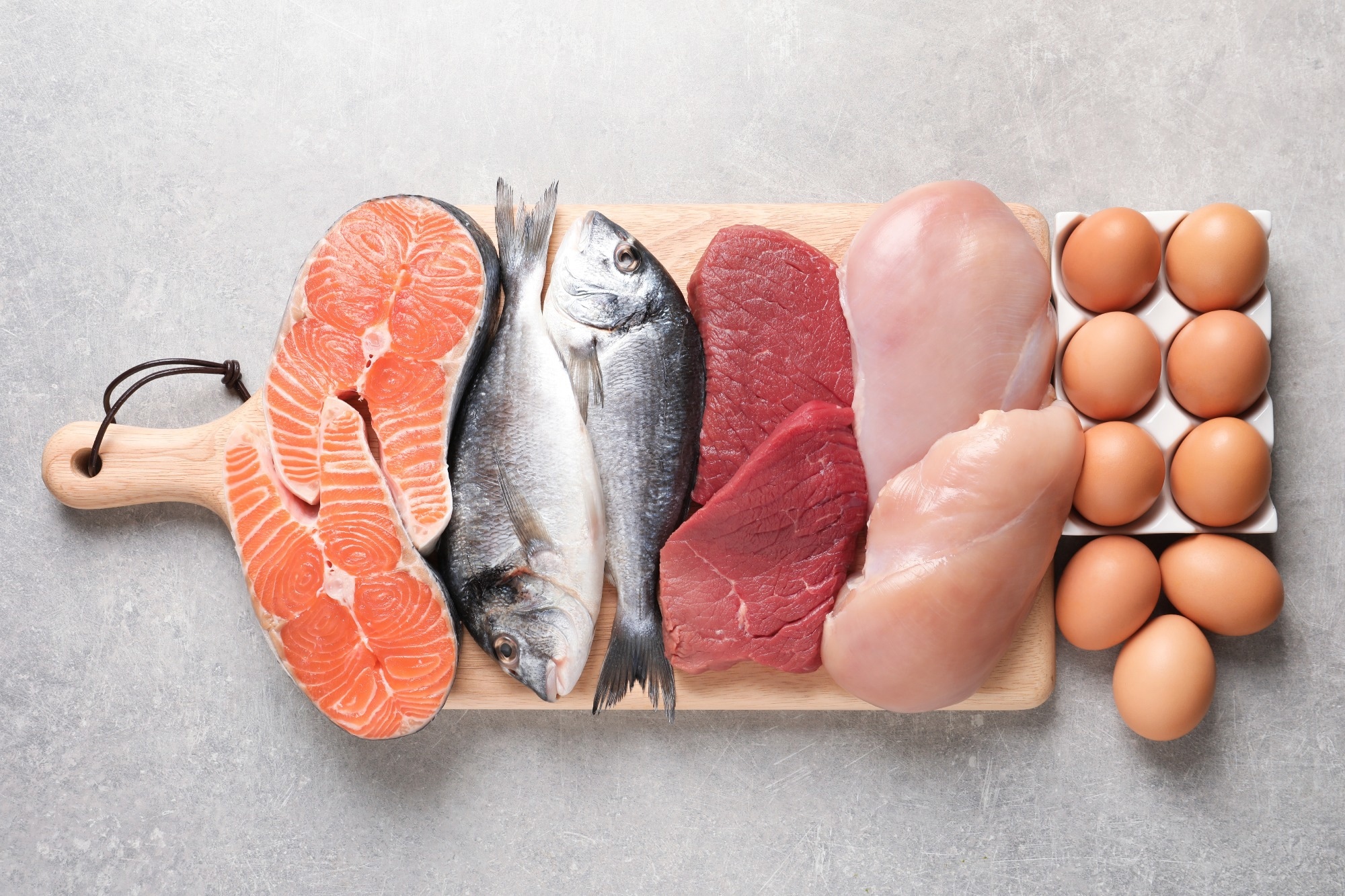 Is there an association between meat and fish consumption and non-alcoholic fatty liver disease?