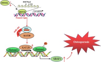 DOT1L decelerates the development of osteoporosis by inhibiting SRSF1 transcriptional activity via microRNA-181-mediated KAT2B inhibition