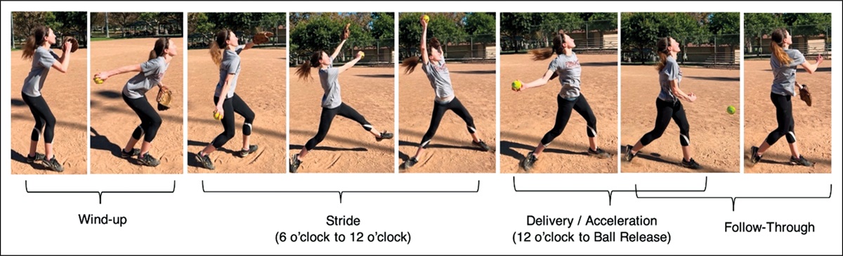 Understanding Shoulder and Elbow Injuries in the Windmill Softball Pitcher