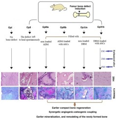 Regenerative effect of microcarrier form of acellular dermal matrix versus bone matrix bio-scaffolds loaded with adipose stem cells on rat bone defect