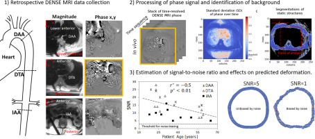 Correction of phase offset errors and quantification of background noise, signal-to-noise ratio, and encoded-displacement uncertainty on DENSE MRI for kinematics of the descending thoracic and abdominal aorta