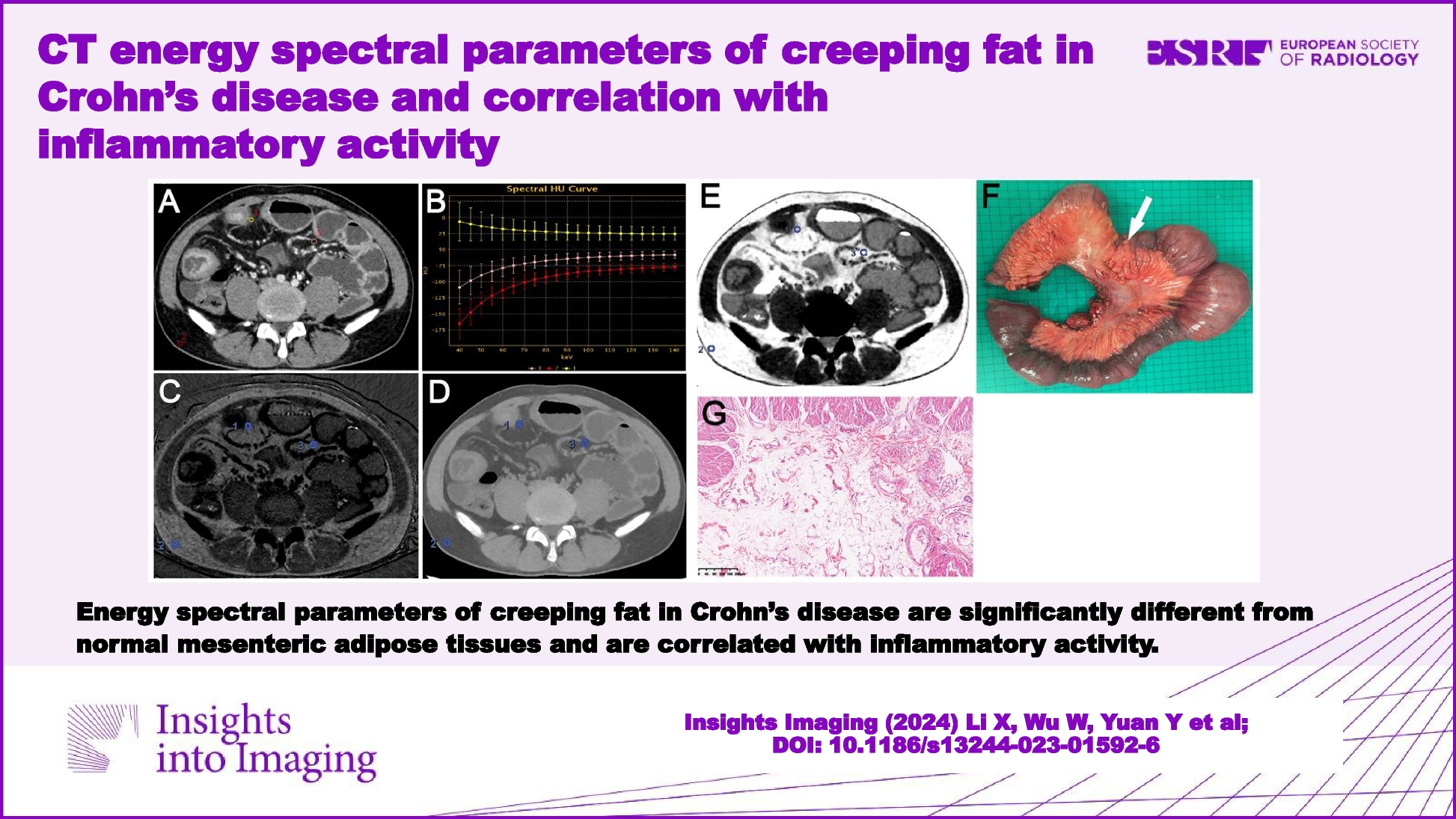 CT energy spectral parameters of creeping fat in Crohn’s disease and correlation with inflammatory activity