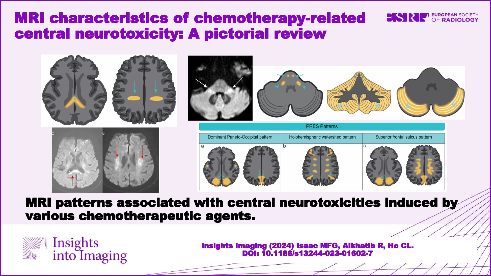 MRI characteristics of chemotherapy-related central neurotoxicity: a pictorial review