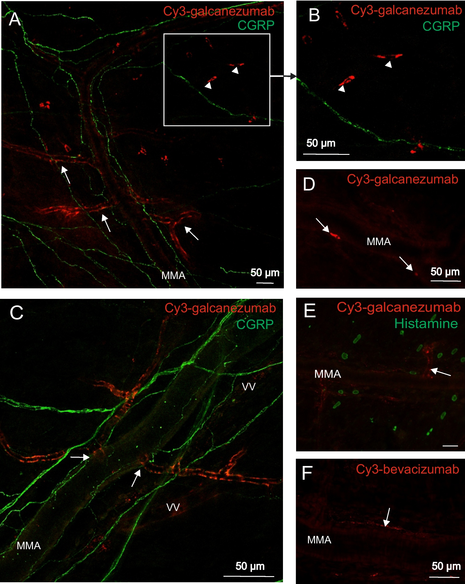 Anti-CGRP antibody galcanezumab modifies the function of the trigeminovascular nocisensor complex in the rat