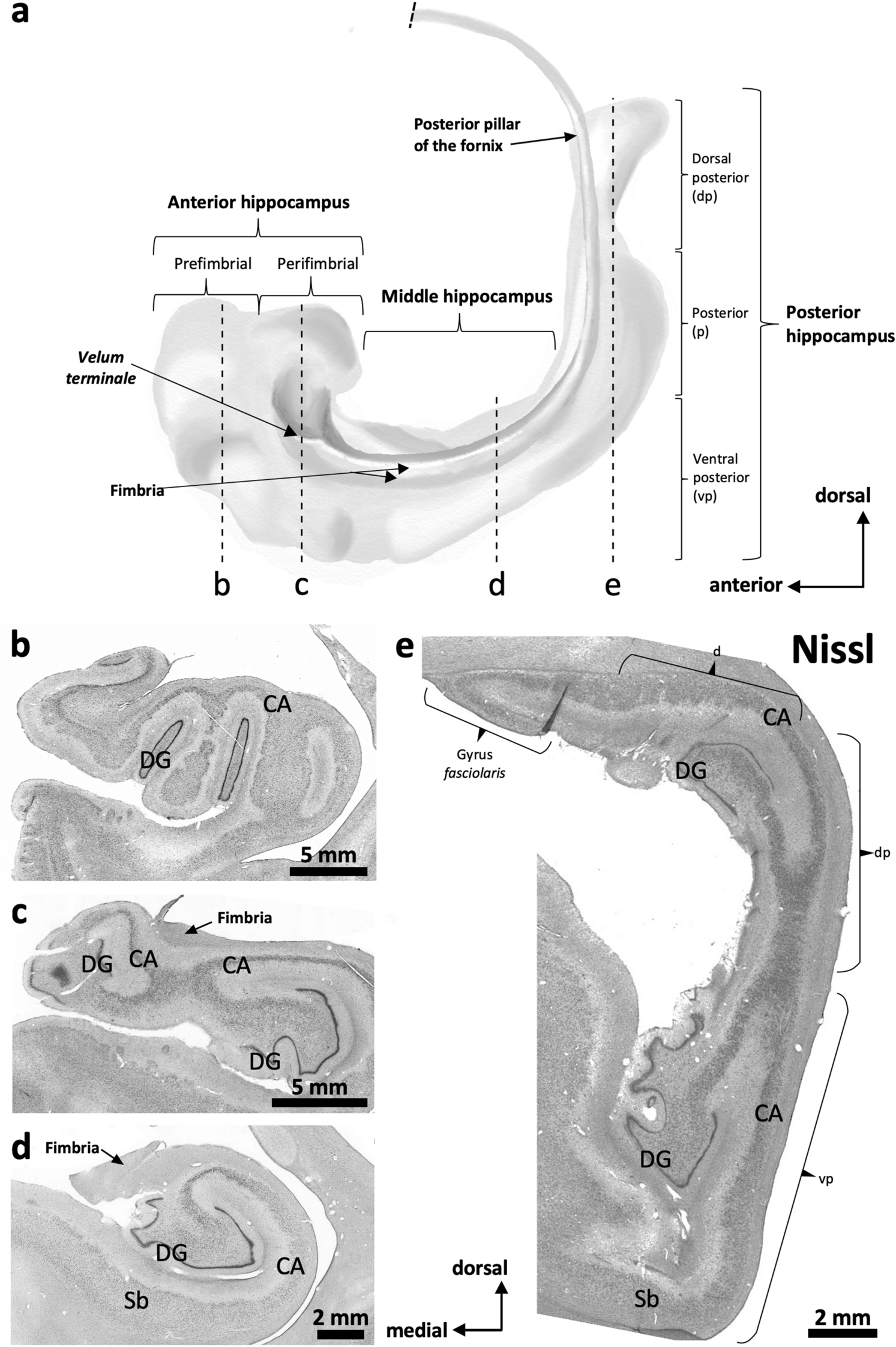 Immunohistochemical field parcellation of the human hippocampus along its antero-posterior axis