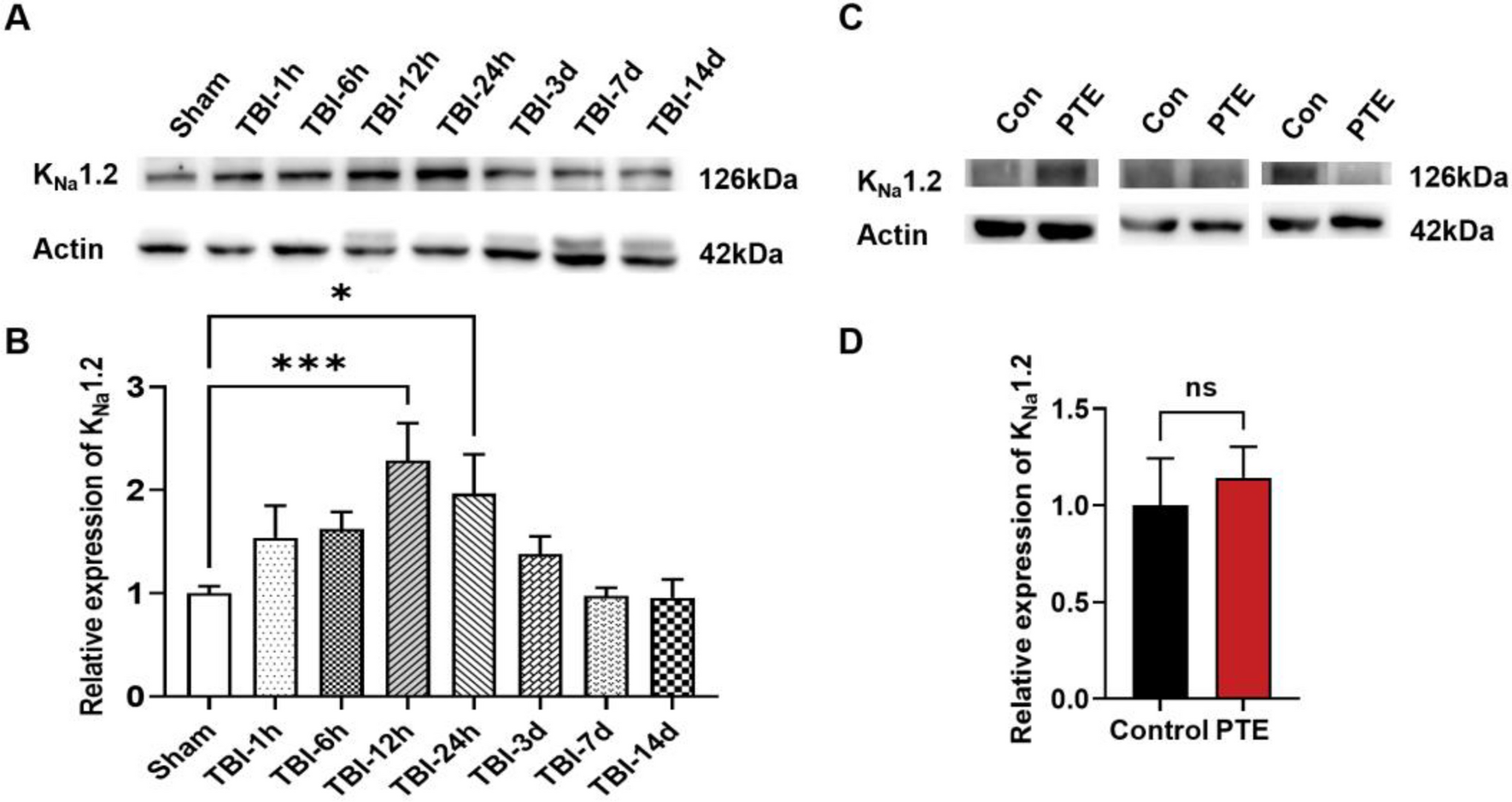 Increased Expression of KNa1.2 Channel by MAPK Pathway Regulates Neuronal Activity Following Traumatic Brain Injury