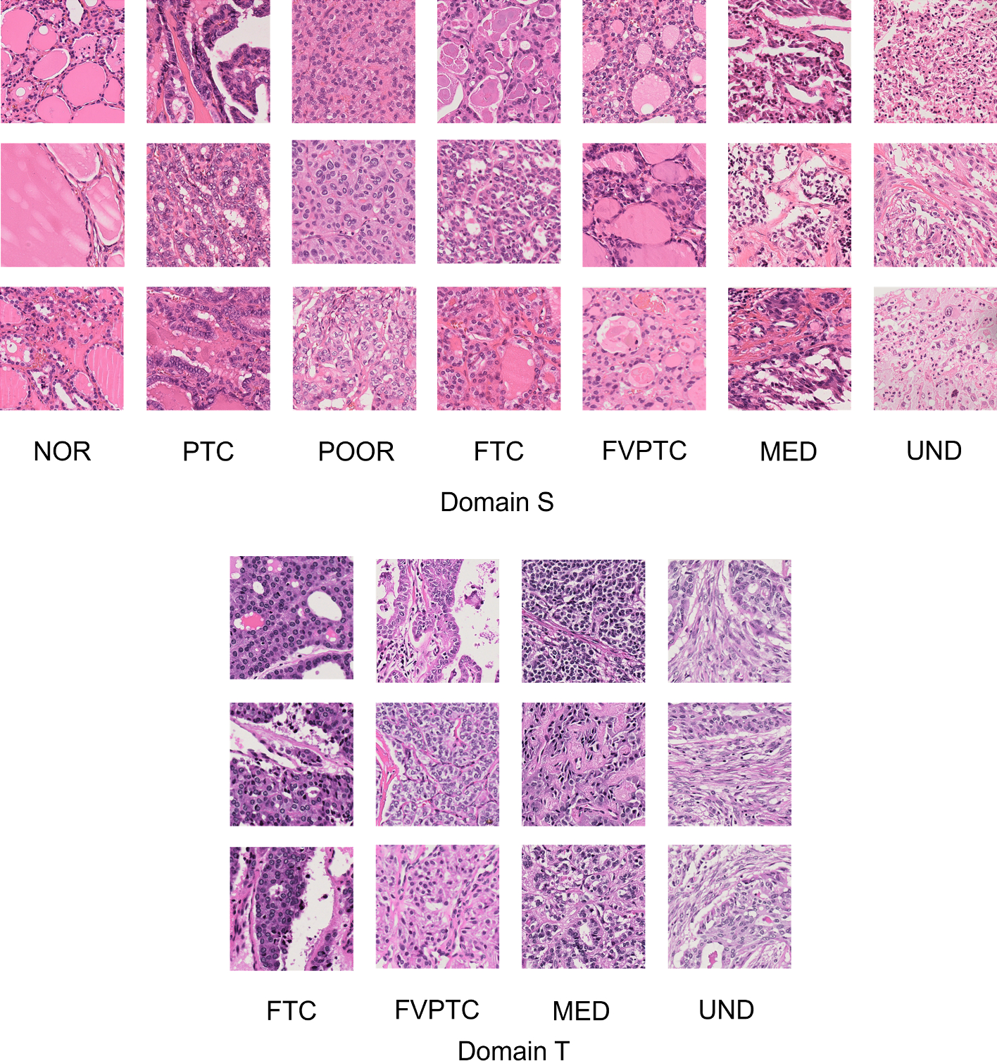 Domain transformation using semi-supervised CycleGAN for improving performance of classifying thyroid tissue images