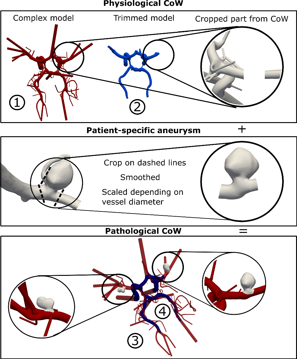 Image-based hemodynamic simulations for intracranial aneurysms: the impact of complex vasculature