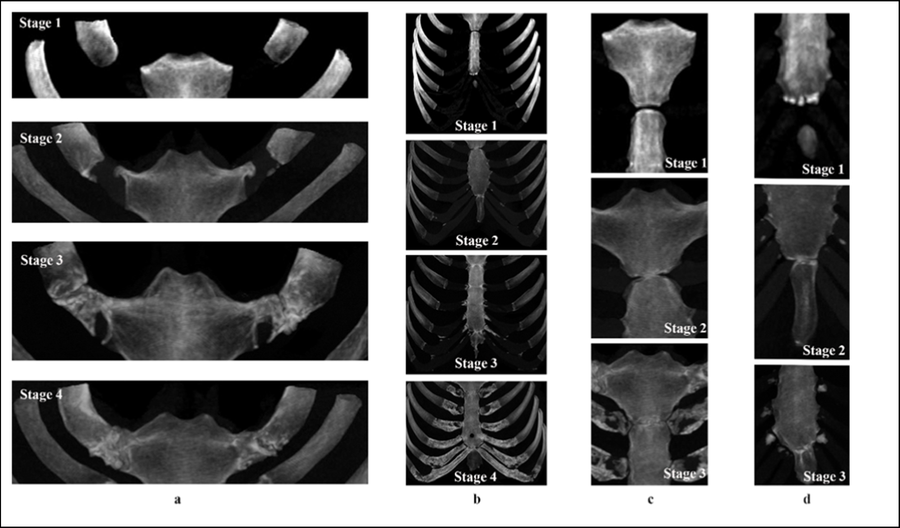 Adult age estimation from the sternum using maximum intensity projection images of CT and data mining in a Chinese population