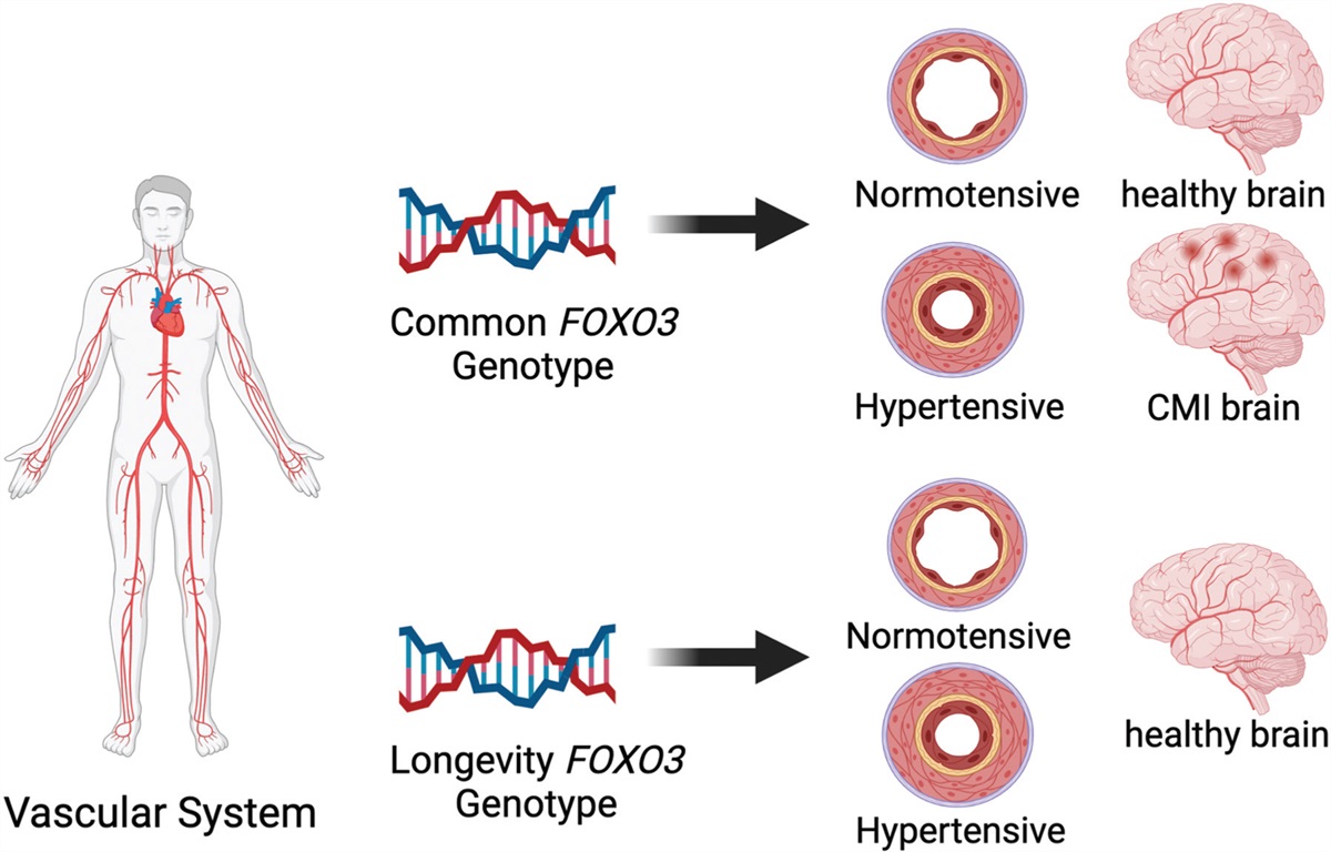FOXO3 longevity genotype attenuates the impact of hypertension on cerebral microinfarct risk