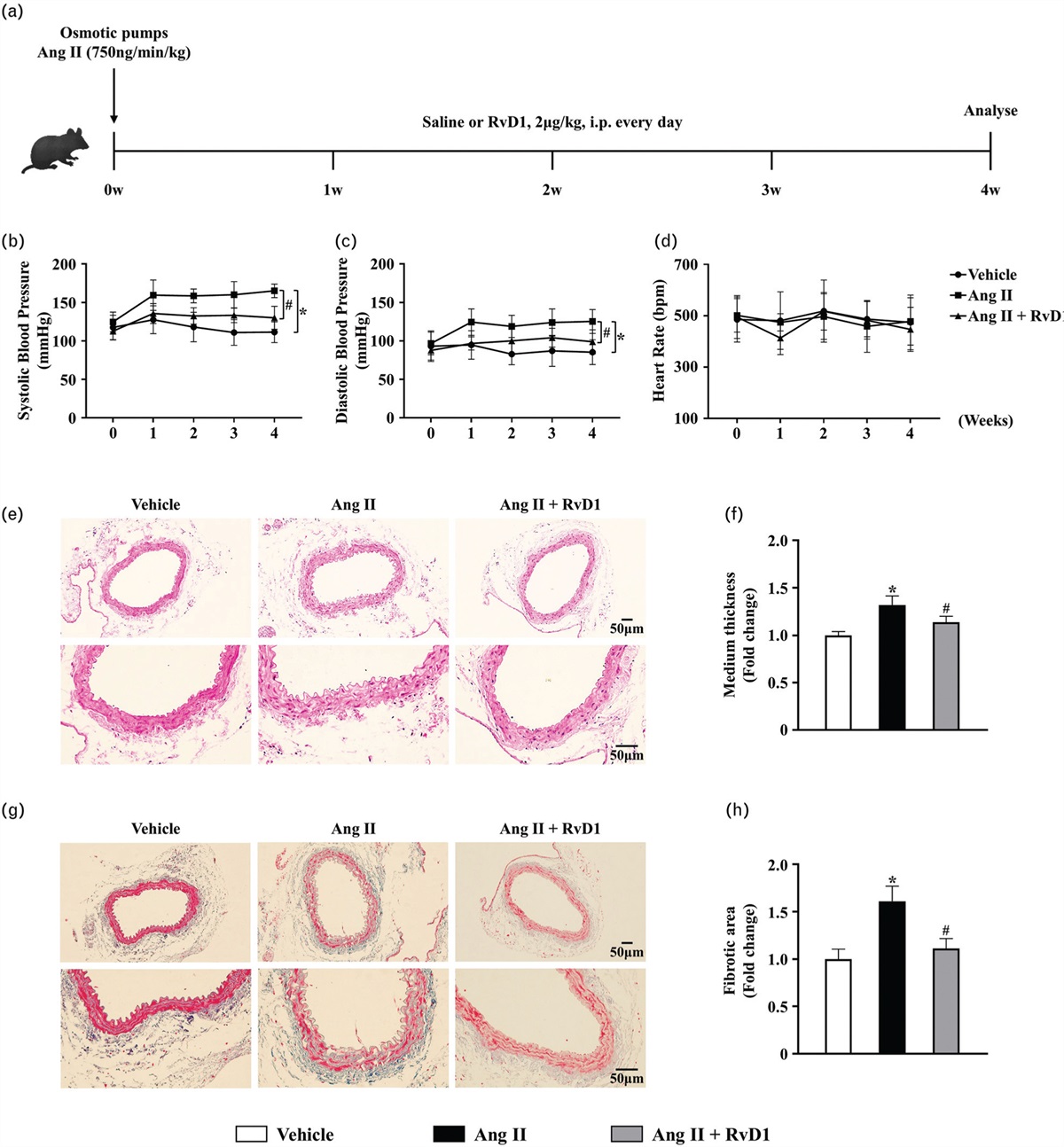 Resolvin D1 attenuates Ang II-induced hypertension in mice by inhibiting the proliferation, migration and phenotypic transformation of vascular smooth muscle cells by blocking the RhoA/mitogen-activated protein kinase pathway