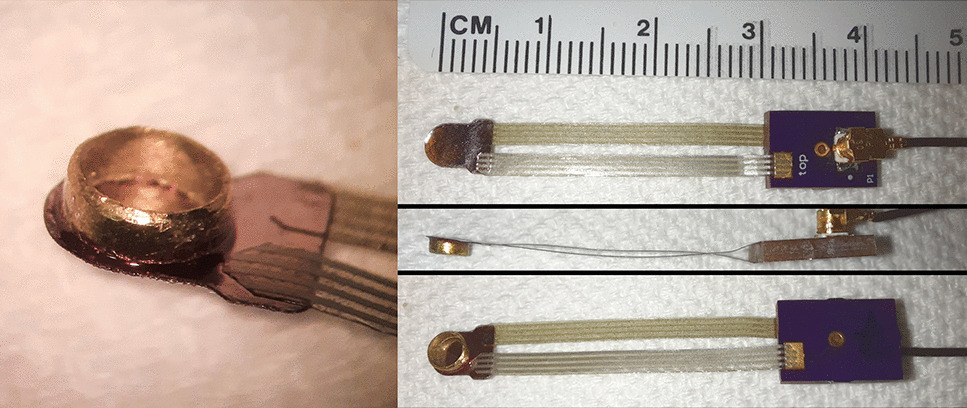An Implantable Piezofilm Middle Ear Microphone: Performance in Human Cadaveric Temporal Bones