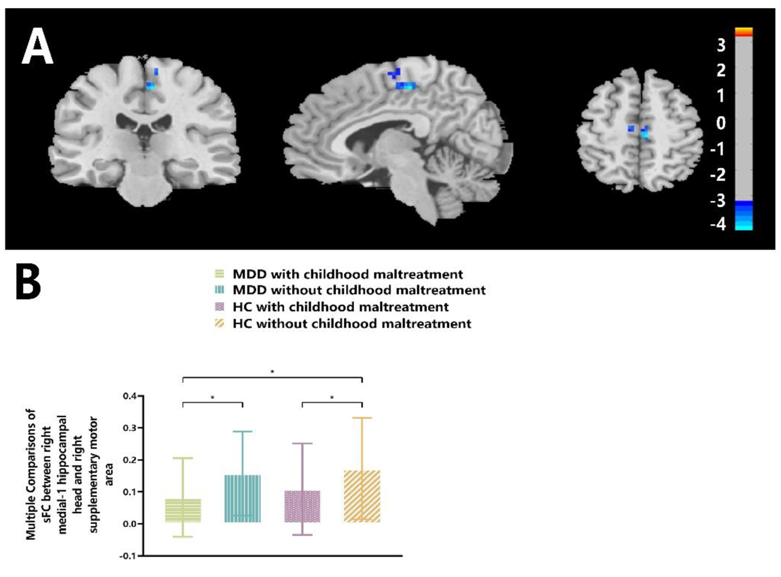 Effects of childhood maltreatment and major depressive disorder on functional connectivity in hippocampal subregions
