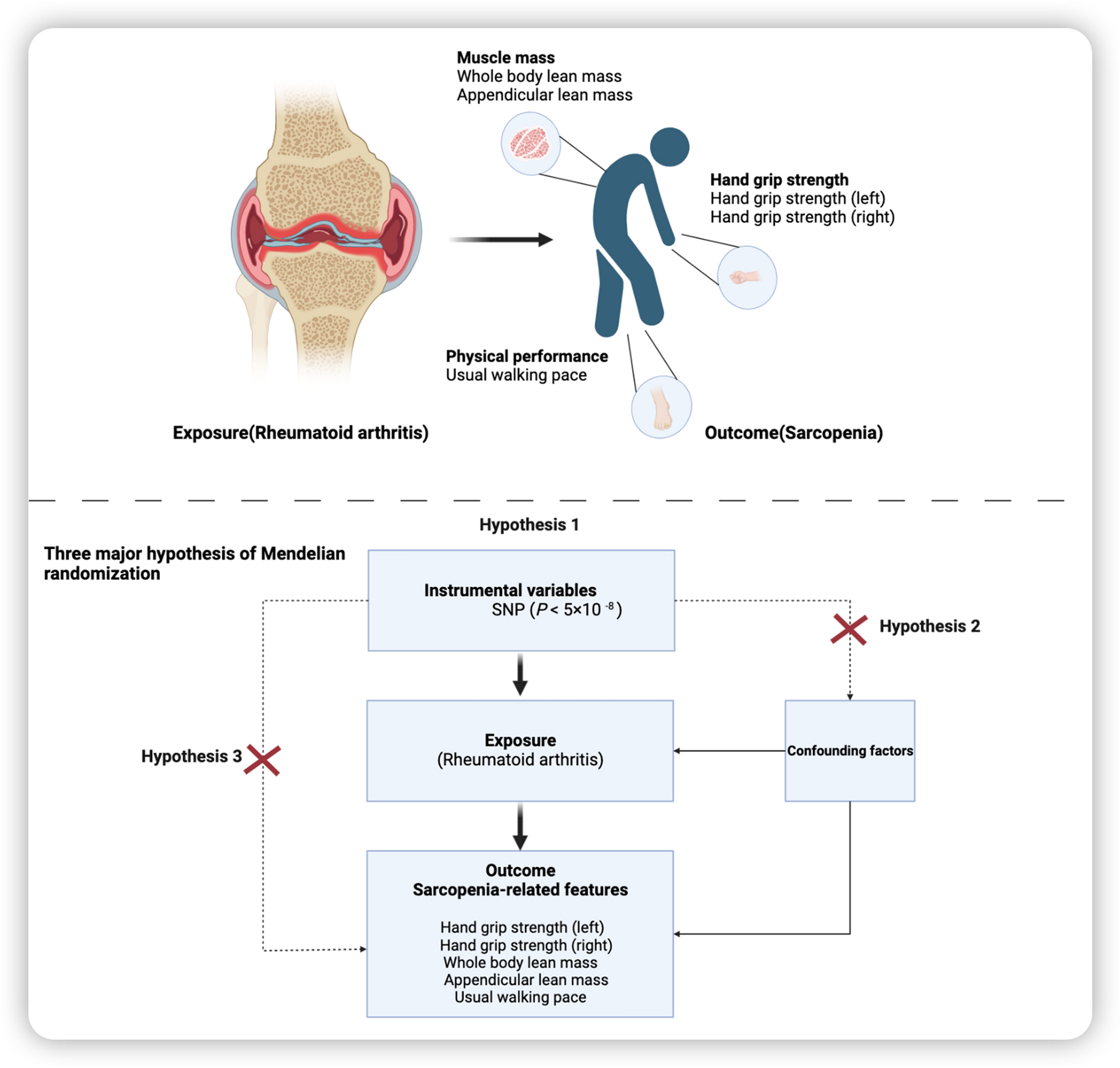 The Effect of Rheumatoid Arthritis on Features Associated with Sarcopenia: A Mendelian Randomization Study