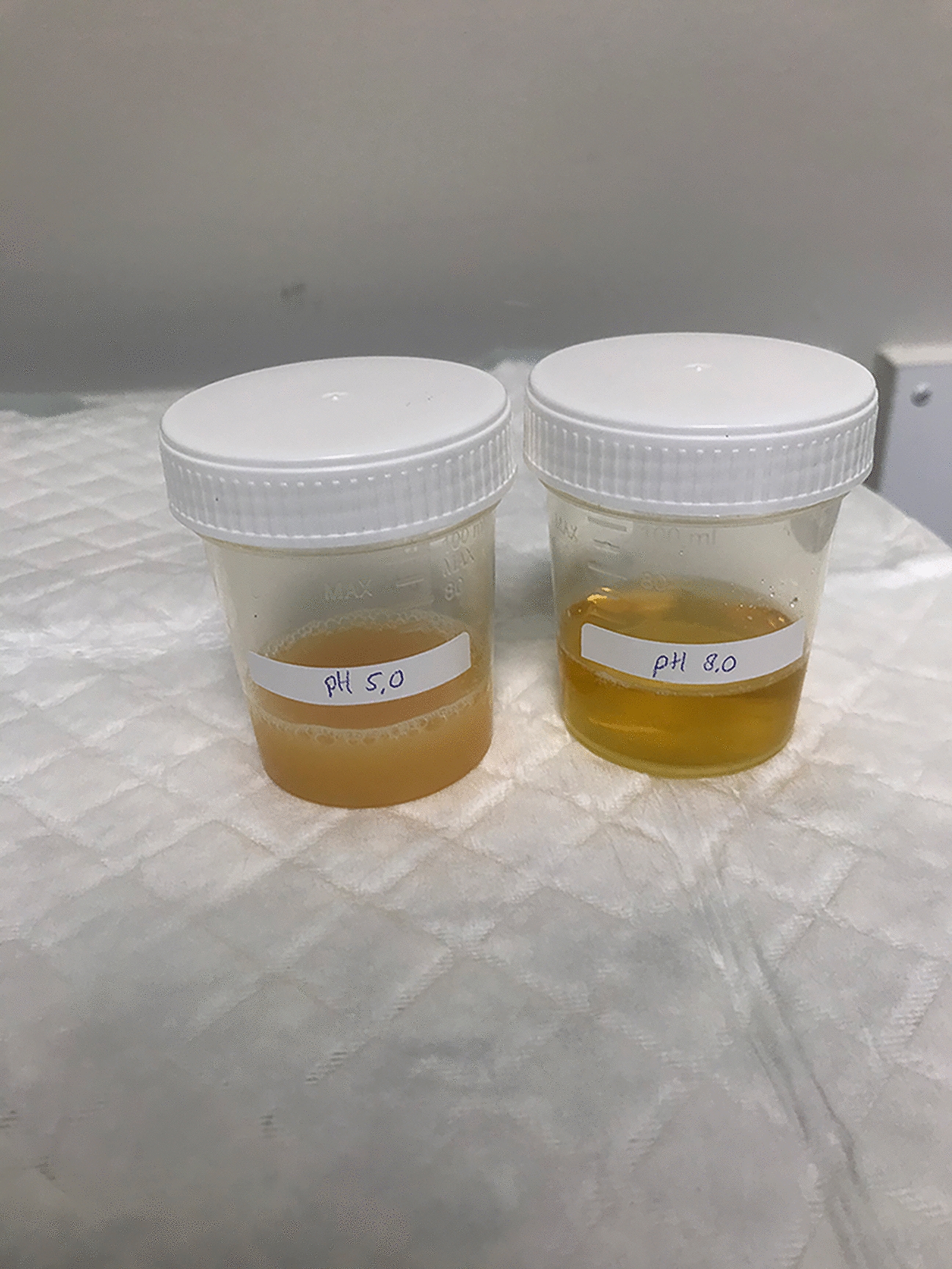 Intraoperative cloudy urine due to propofol-induced crystallization of uric acid