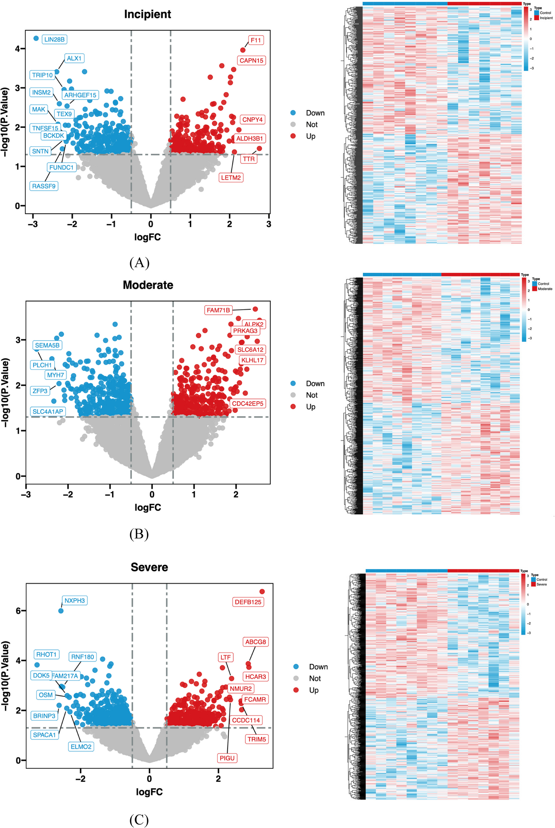 Bioinformatics to analyze the differentially expressed genes in different degrees of Alzheimer’s disease and their roles in progress of the disease