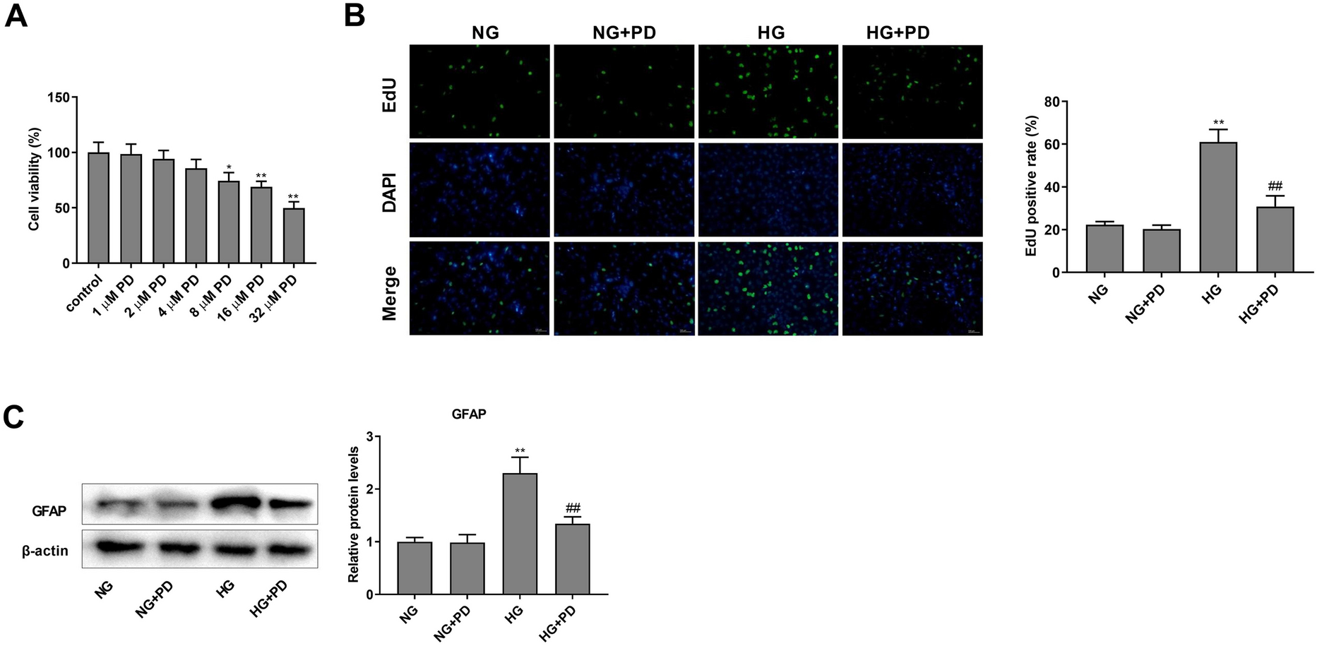 PD protects Müller cells through the SIRT1/NLRP3 inflammasome pathway