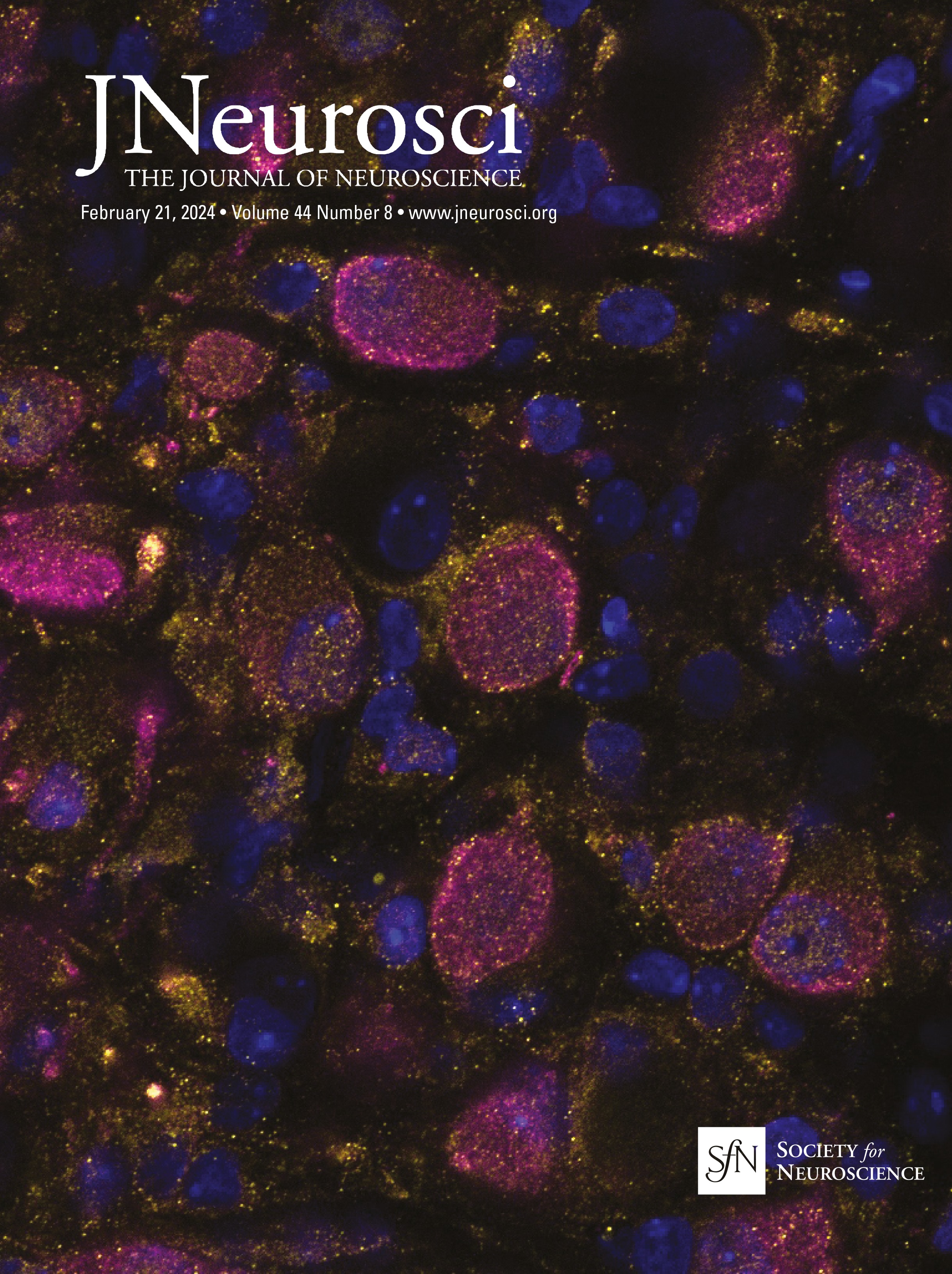 Diurnal Variation of Brain Activity in the Human Suprachiasmatic Nucleus