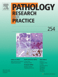 Tumor-stroma ratio in preoperative biopsies and matched surgical specimens in oral squamous cell carcinoma: Concordance and impact on recurrence-free and overall survival