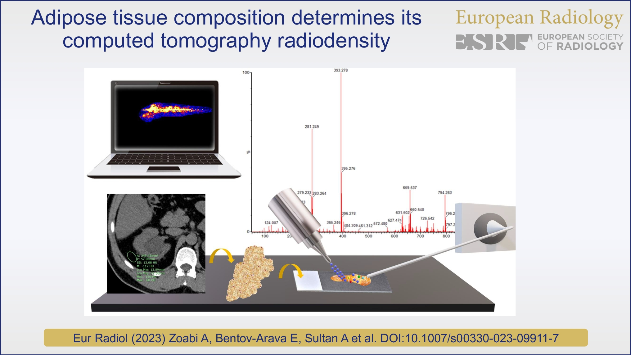 Adipose tissue composition determines its computed tomography radiodensity