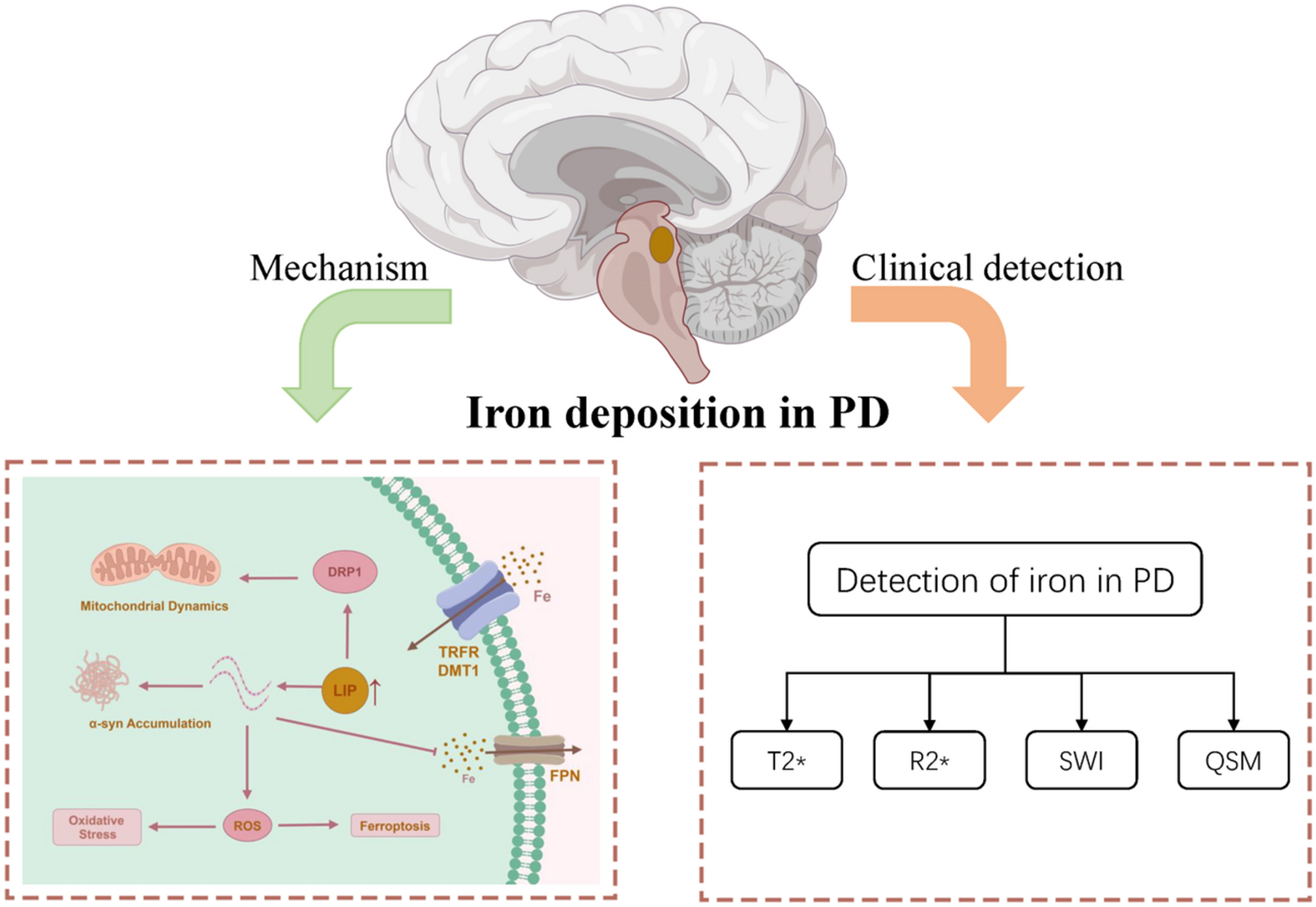 Iron Deposition in Parkinson’s Disease: A Mini-Review