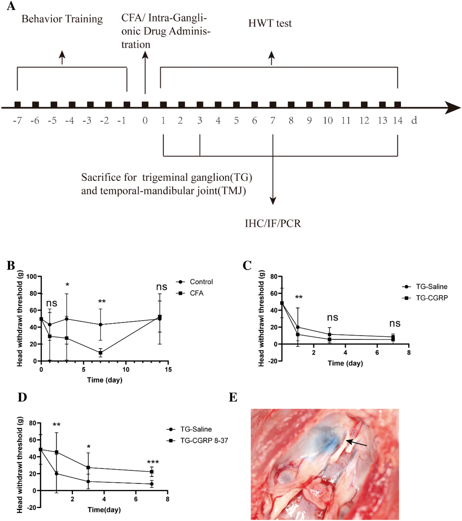 Expression of CGRP in the Trigeminal Ganglion and Its Effect on the Polarization of Macrophages in Rats with Temporomandibular Arthritis