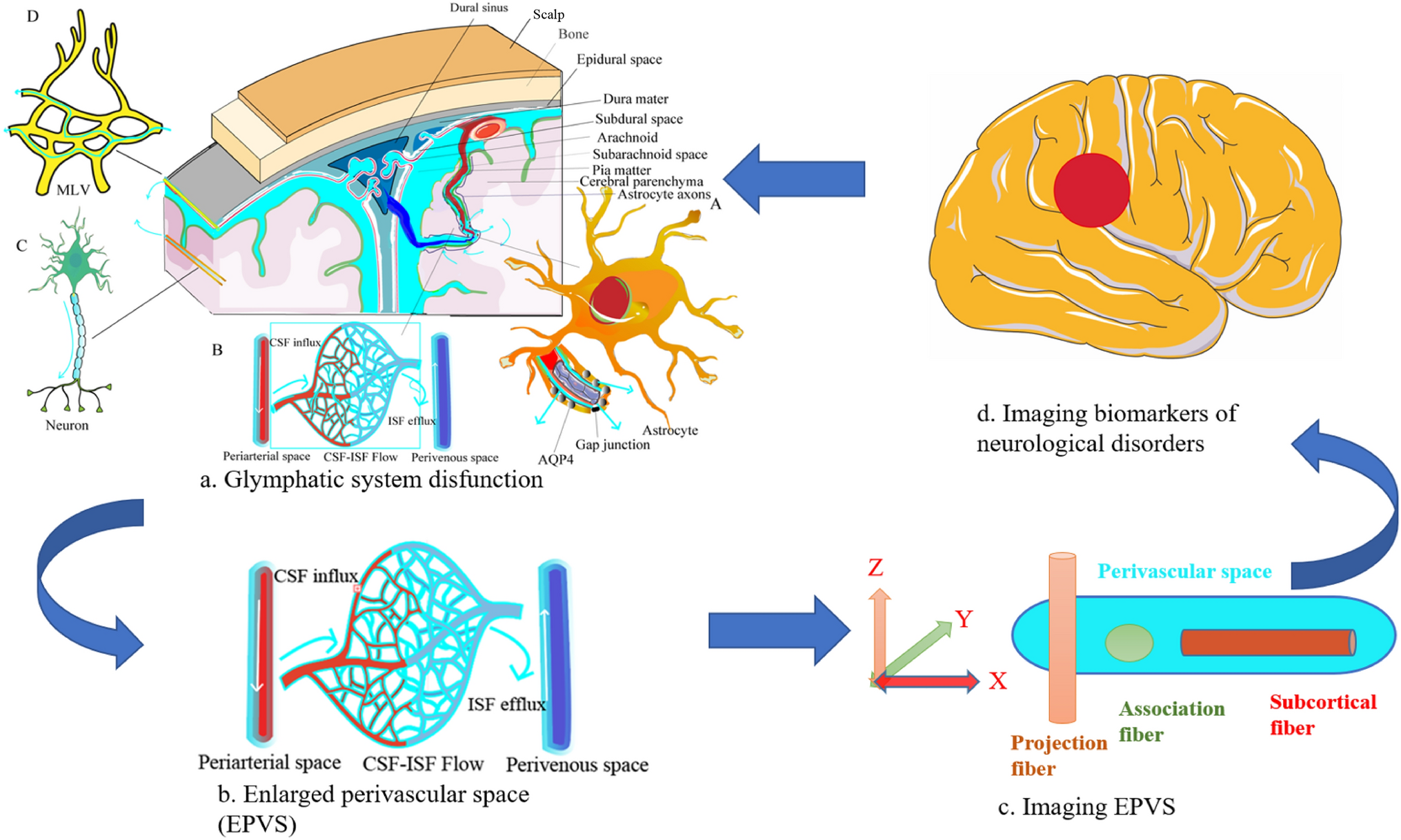 Enlarged Perivascular Space and Index for Diffusivity Along the Perivascular Space as Emerging Neuroimaging Biomarkers of Neurological Diseases